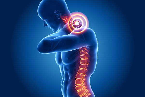 Ortopedia - CERVICOBRAQUIALGIA