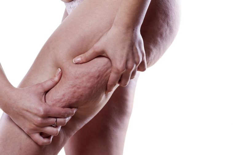 Fisioterapia - DRENAGEM LINFATICA